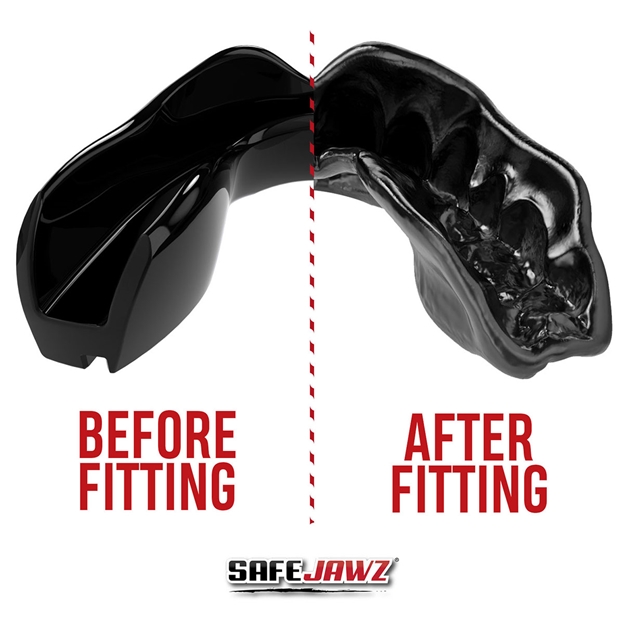 SafeJawz Intro Series Black Mouthguard - Before/After
