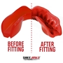 SafeJawz Intro Series Red Mouthguard - Before/After 