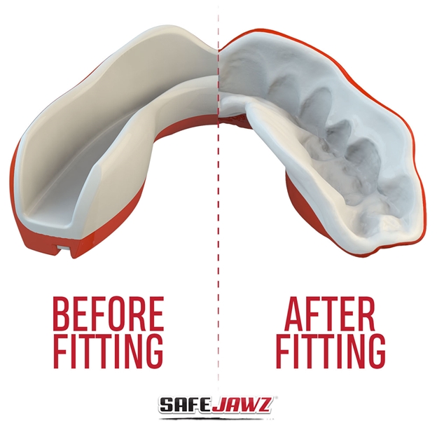 SafeJawz Viper Mouthguard - Detail 1