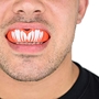 SafeJawz Viper Mouthguard - Model 