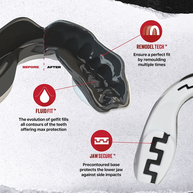 SafejawzMASTER-Mo-Mouthguard - Fitting.jpg