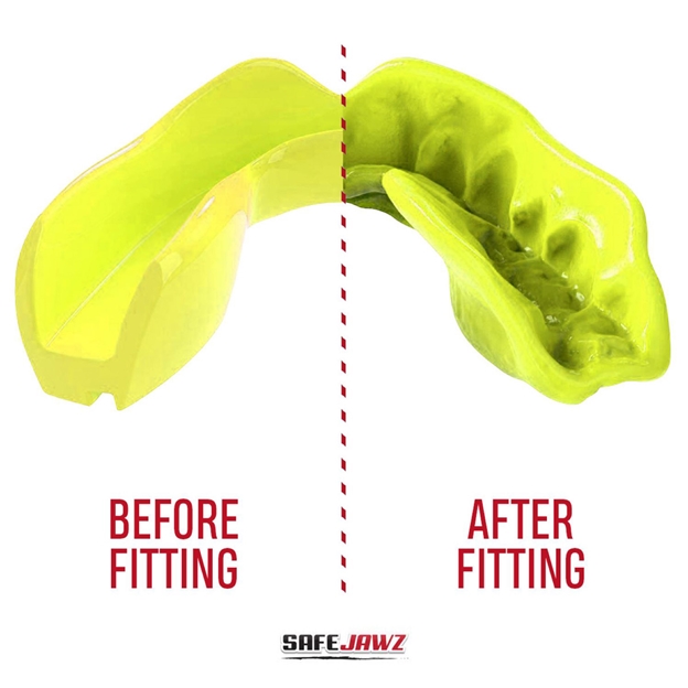 SafeJawz Intro Series Fluro Yellow Mouthguard - Bite